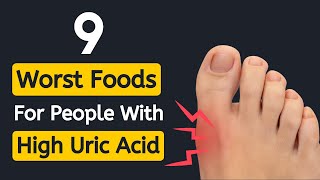 9 Worst Foods For People With High Levels of Uric Acid | Foods that Increase Uric Acid: Manage Gout