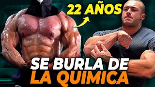 GENETIC Anomaly 22 años y ESTÁ ASÍ... Mi DURA OPINIÓN