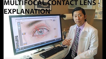 Healthy Eyes Optometry: Multifocal Contact Lens Explanation