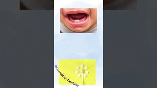 How do I know if my baby is teething?