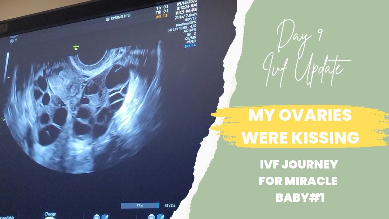My Ovaries Were Kissing Each Other | Day 8 IVF Ultrasound Update