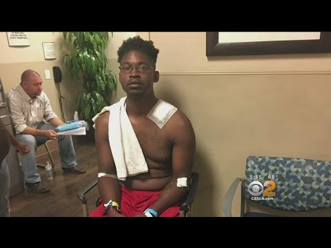 Vegas Survivor Shot In Neck While Helping Others