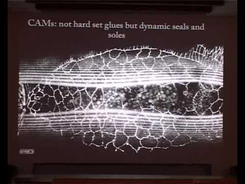 The importance of cellular interfaces in patterning tissues by Maitreyi Narasimha