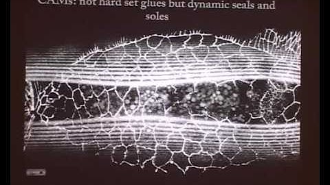 The importance of cellular interfaces in patterning tissues by Maitreyi Narasimha