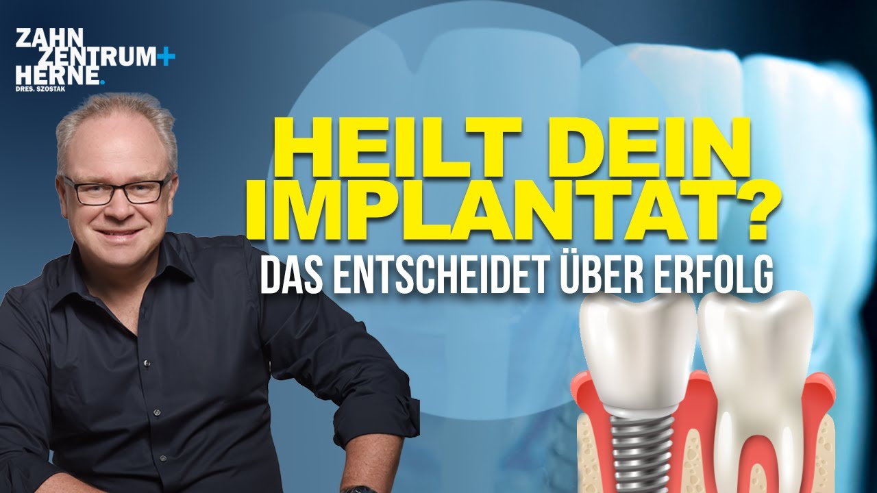 Wie heilen Implantate richtig ein? Die wichtigsten Faktoren erklärt