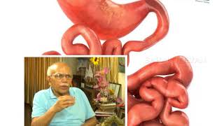 NANK: Dr BM Hegde on Constipation/ಮಲಬದ್ಧತೆ Part -II