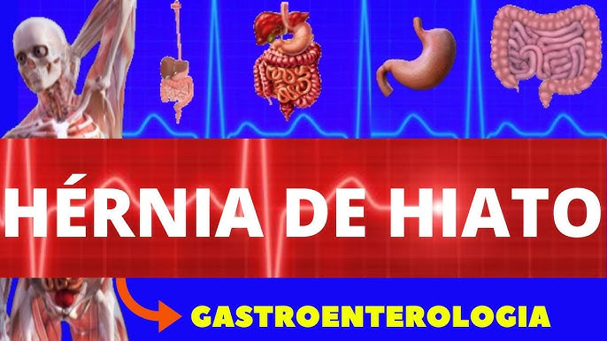 6 passos para recuperação após cirurgia de hérnia de hiato - SBH