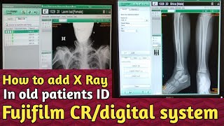 CR system mein same id mein x-ray kaise karte hain । Recover image CR system । Uday xRay screenshot 4