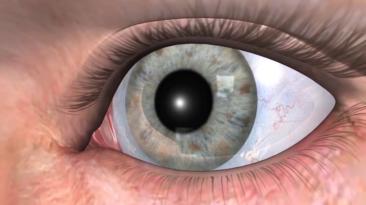 Macular Degeneration Desert Family Vision Center YouTube