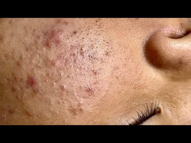 Satisfying video with Chung Vo Spa |233