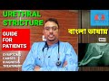 Urethral Stricture প্রস্রাব পাইপ অপারেশন Stricture urethra | Oiu | treatment of urethral Stricture