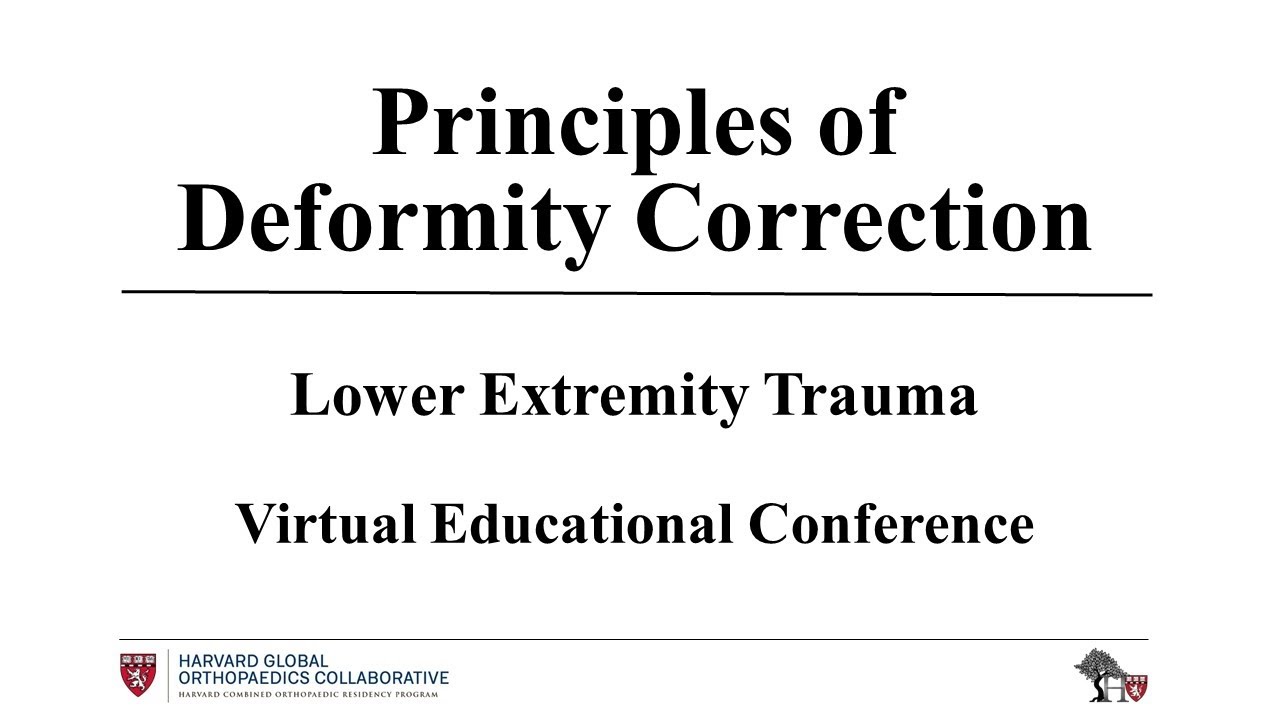 語学・辞書・学習参考書 principles of deformity correction Principles of Deformity Correction: 9783642639531: Medicine