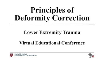 Principles of Deformity Correction