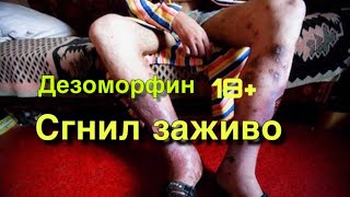 Дезоморфин .Сгнил заживо 18+(Беспридел ГНК )