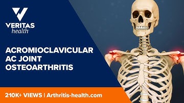 Acromioclavicular AC Joint Osteoarthritis