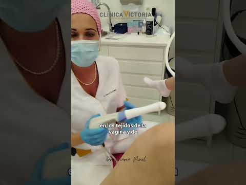 CASO CLINICO DE RADIOFRECUENCIA VAGINAL