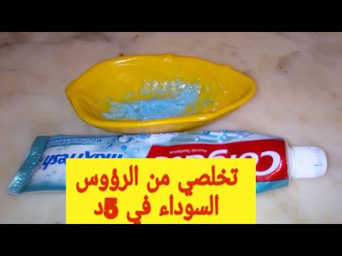 وصفة لازالة الرؤوس السوداء في الأنف و الوجه في 5 دقائق فعالة و مضمونة