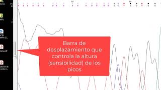 Cromatograma Sanger. Parte 1