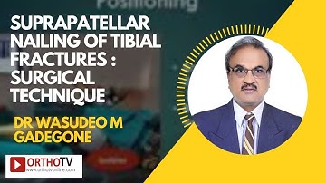 Suprapatellar Nailling of Tibial Fractures: Surgical Technique by Dr Wasudeo M. Gadegone
