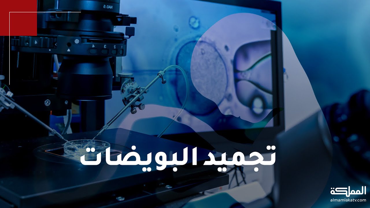عملية تجميد البويضات .. ما هي ؟