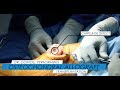 Joint Preservation - Dr. Andreas Gomoll HSS New York City