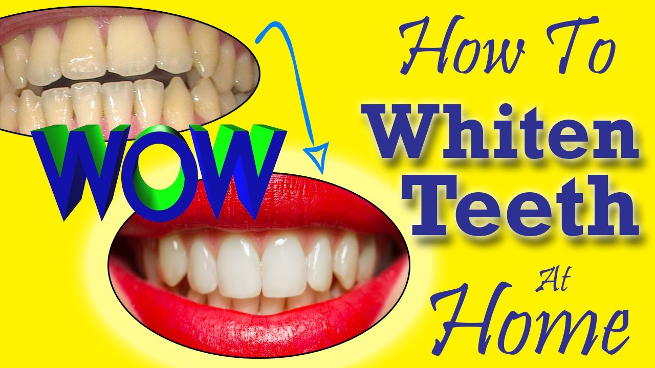 🧧💎How To Whiten Teeth At Home💎🧧 🧶💛How To Whiten Teeth At