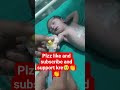I v injection #antibiotic #cute beby#nicu#hospital#viral#subscribe
