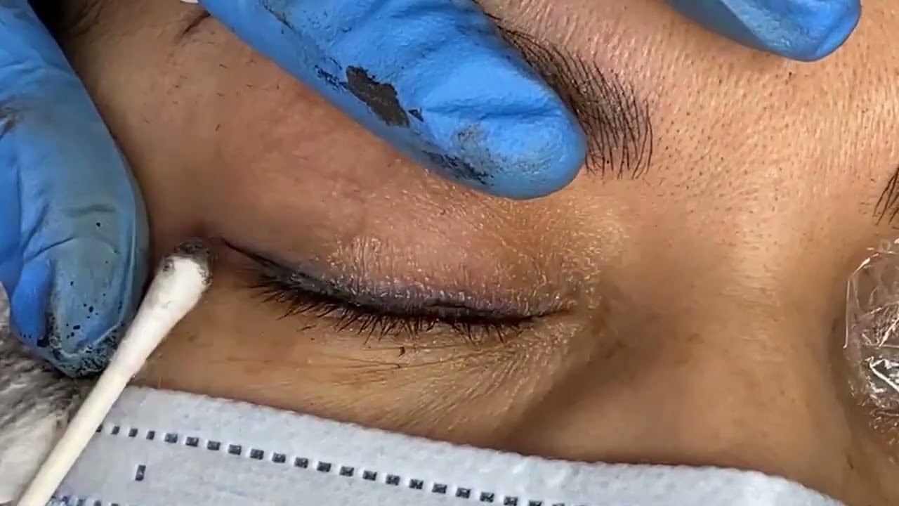 Permanent Eyeliner Application - Full procedure
