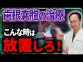 根管治療になってしまった歯の寿命を伸ばすために絶対やってはいけないこと！歯根嚢胞になったら気をつけるべきことをご紹介いたします