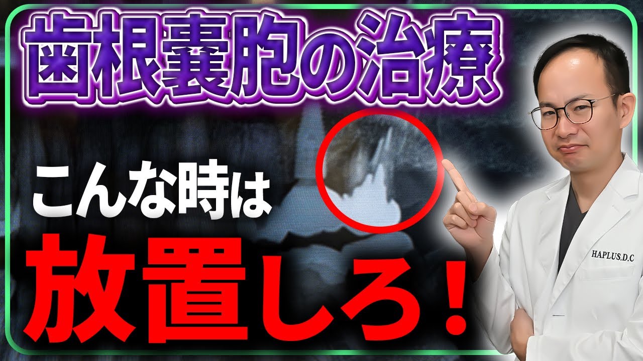 根管治療になってしまった歯の寿命を伸ばすために絶対やってはいけないこと！歯根嚢胞になったら気をつけるべきことをご紹介いたします