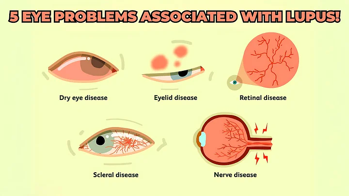 Shocking Revelation About Autoimmune Disease and Eye Health You Need to Know!