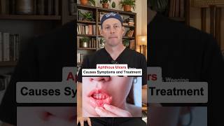 Aphthous Ulcers Causes Symptoms And Treatment