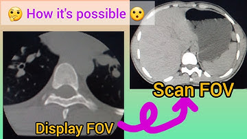 CT scan display FOV and scan FOV | on Toshiba CT console | CT scan basic concept