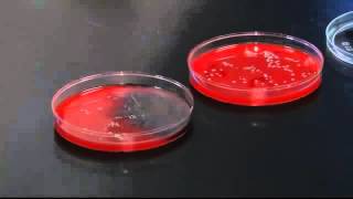 SPECIAL REPORT How dirty are your hands