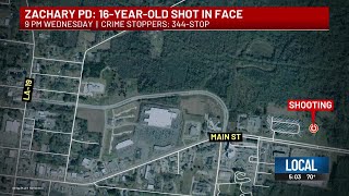 Zachary police investigating after teen shot in the face