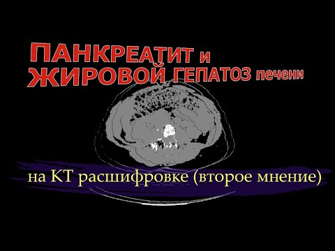 Video: Ооруктан түшкөн жеке киреше салыгы: салык салынуучу пайда