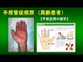 手根管症候群（高齢患者）手術症例 2024.9