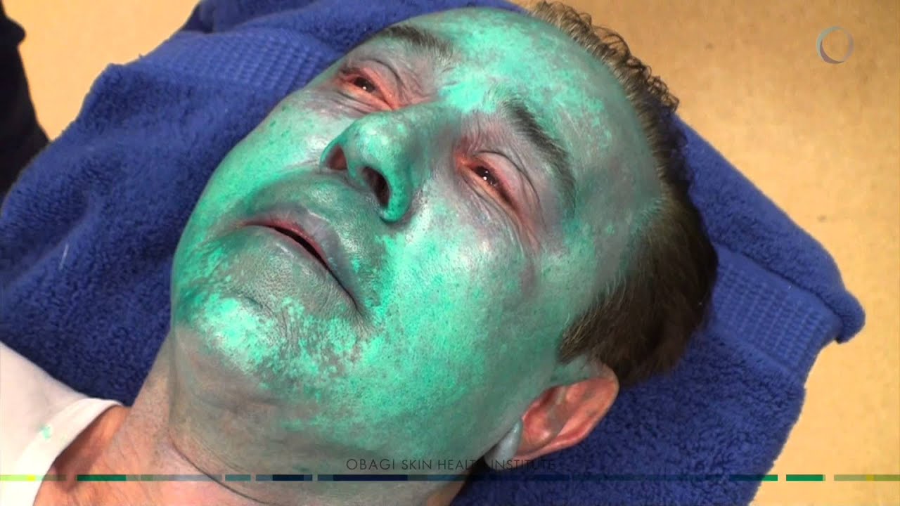 Dr Zein Obagi Is Having A Peel Youtube