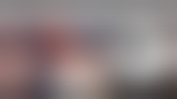 dynaMet™ Lesser TMT Fusion System - Cadaveric Surgical Demo