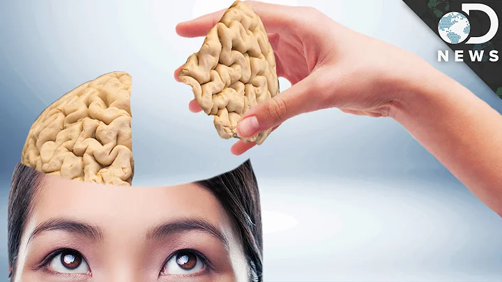 Can You Live With Only Half Of Your Brain?