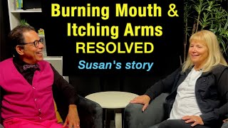 Burning Mouth Syndrome & Arm Itching (Brachioradial Pruritis) resolved- Susan