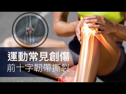 運動常見創傷  前十字韌帶撕裂 | 聯匯專科中心Specialists Central