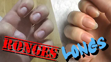 Comment retrouver ses ongles après les avoir rongés