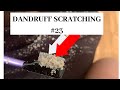 Dandruff scratching #23