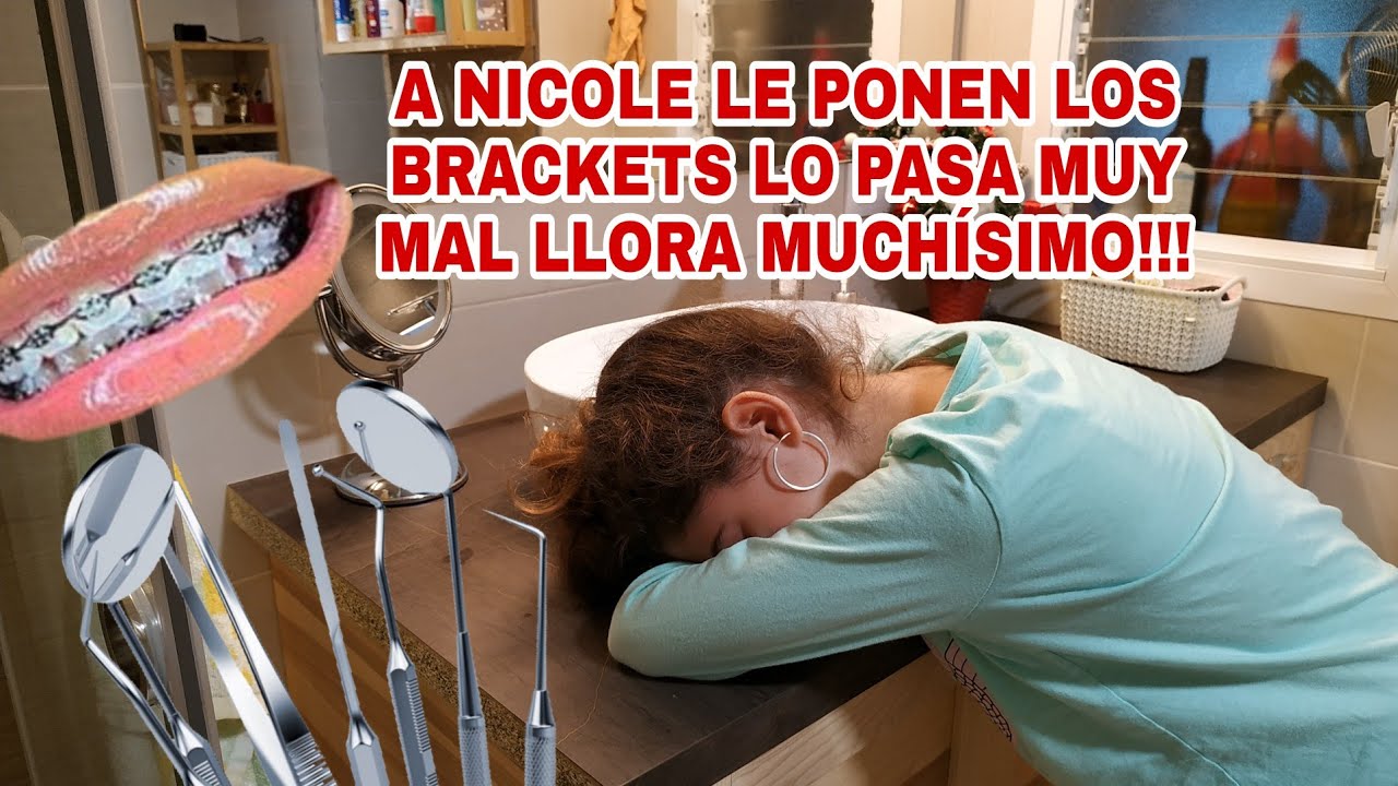 Nicole se pone los brackets, lo pasa muy mal, llora muchisimo/sorpresas navideñas