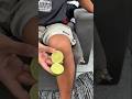 Doctors hate this weird trick withlemon on the knees #shorts