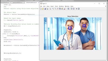 Face detection with MATLAB | with  static image source code