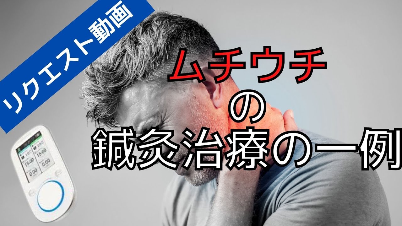 むちうちの鍼治療の一例｜リクエスト動画