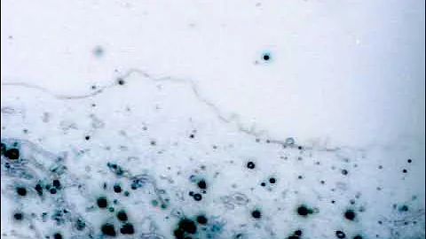 Short movie Fibroblast mitochondria