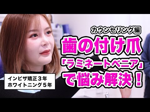 歯の色と形をラミネートべニアで解決！（カウンセリング編）